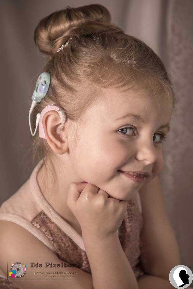 CI Kopf 2018 weiblich Kind